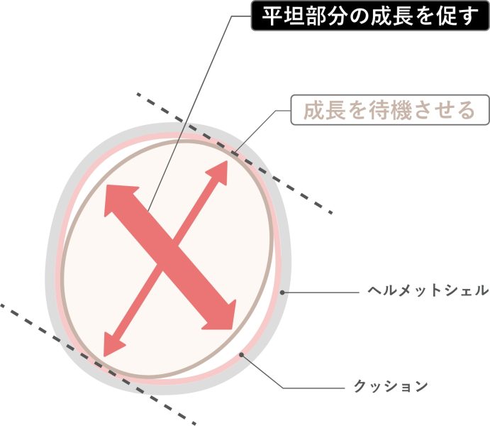 頭のかたち外来ページ 治療原理
